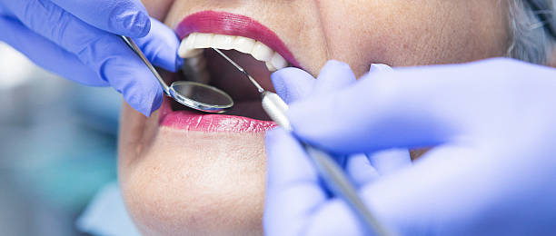 Best Emergency Treatment for Oral Infections in Feather Sound, FL